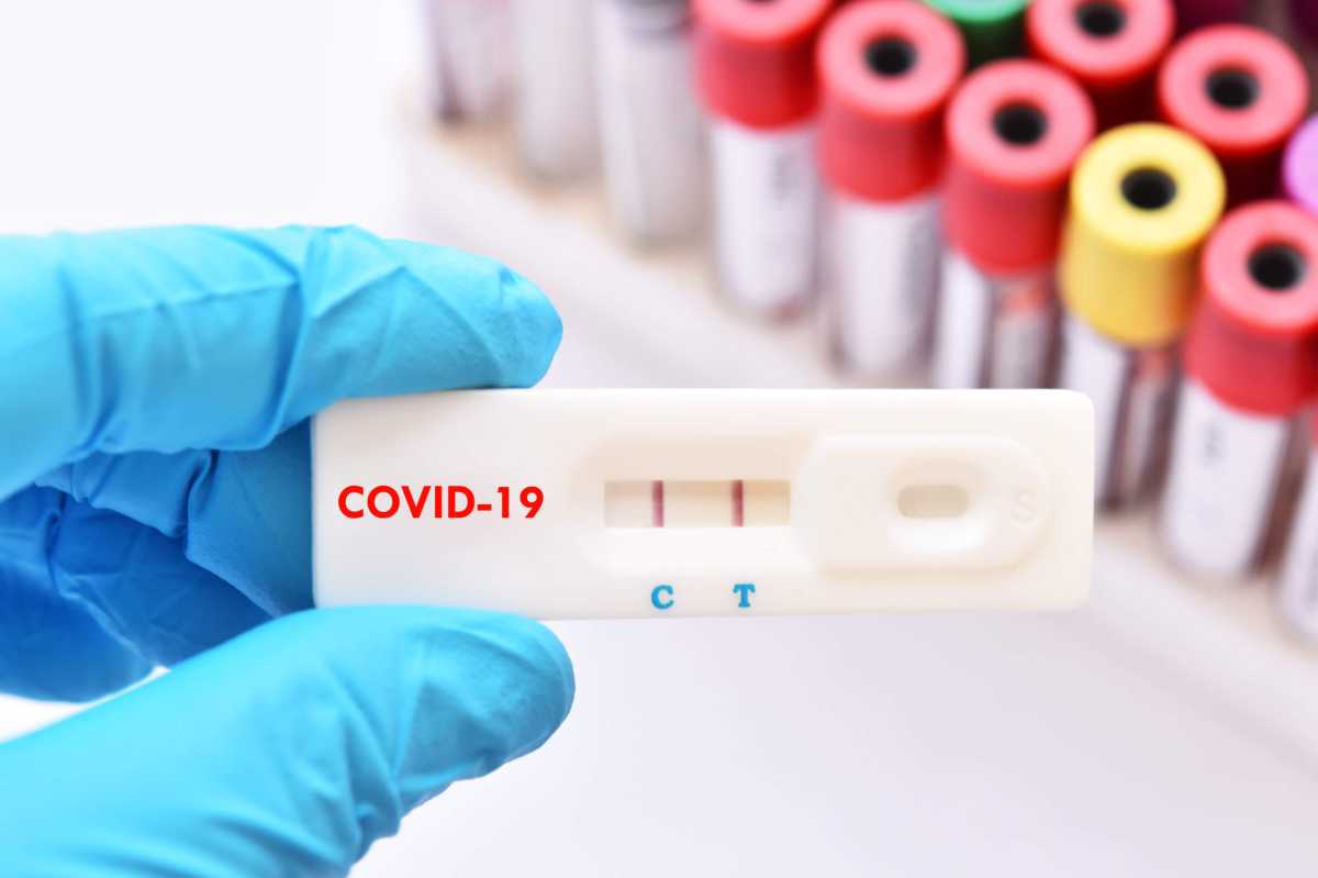 Positive test result of COVID-19 virus