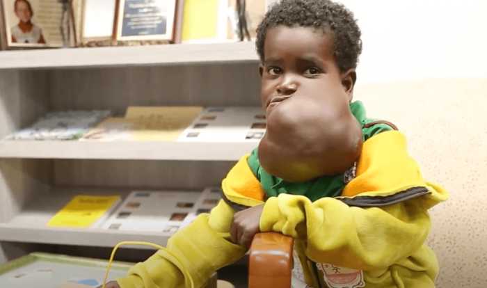 Lenox Hill doctors perform lifesaving surgery on Ethiopian child 2