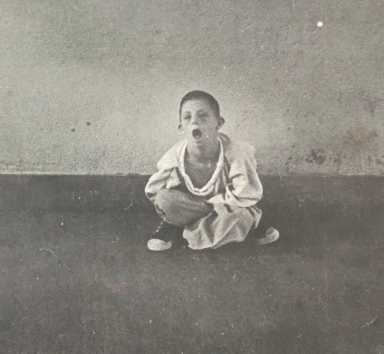 The legacy of Willowbrook State School hangs heavy over advocates who fear the system built to serve the developmentally disabled may be backsliding amid stagnant funding from the state.