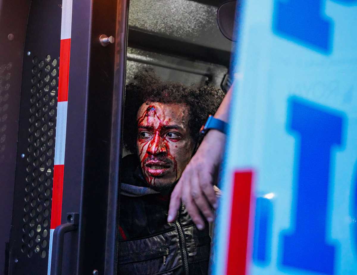 Man bloodied at Jordan Neely protest