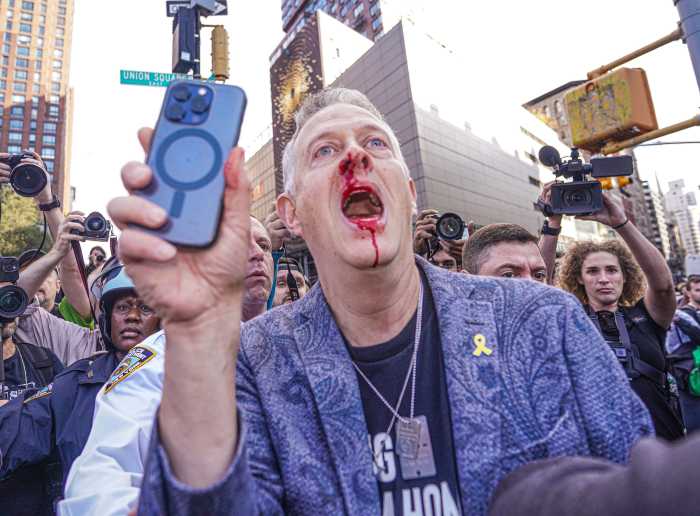 Israel advocate mobbed, attacked by pro-Palestine protestors in Union Square 4 The pro-Israel protester bloodied following the confrontation.