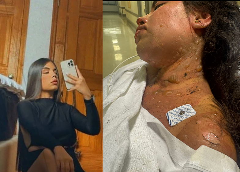 Exclusive: Family of Queens bartender demands answers after she was set on fire and severely burned during lounge show 1 IMG_5201